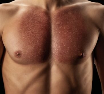 Ursachen und Behandlungsmöglichkeiten für ein unangenehmes Gefühl unter dem rechten Rippenbogen